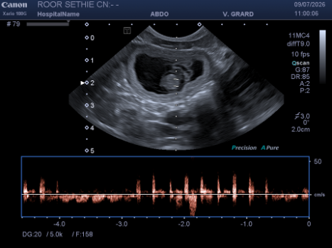 Naissance début Aout 2026